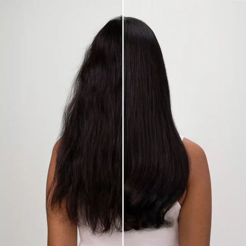 Anti-Dandruff Shampoo Bundle